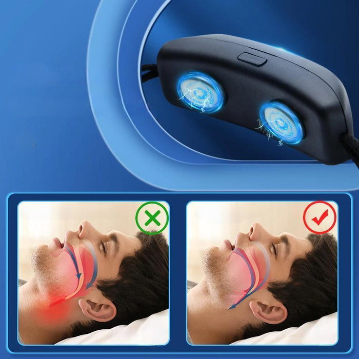 Portable Smart Anti - Snoring Device – USB Rechargeable Aid for Comfortable, Snore - Free Sleep and Sleep Apnea Relief - Gear Elevation