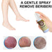 Fungal Treatment Foot Spray - Gear Elevation