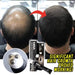 Scalp Intense™ - Hair Growth Serum - Gear Elevation