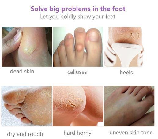 Silky Feet™ - Exfoliating Foot Masks (Buy 1, Get 2 FREE) - Gear Elevation