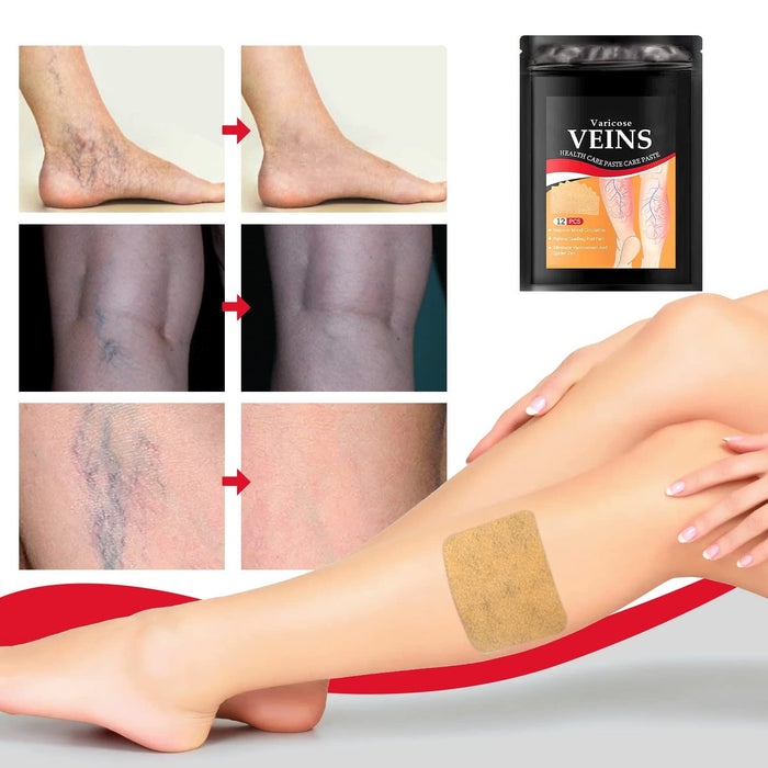 Varicose Veins Treatment Patch - Gear Elevation